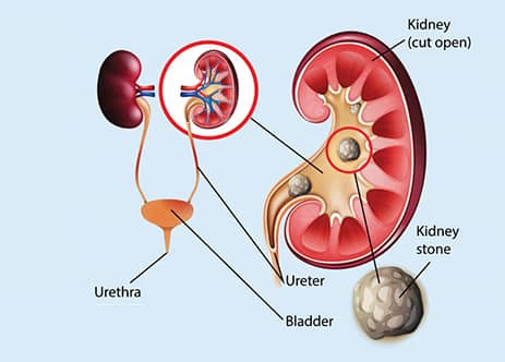 laproscopic-surgery