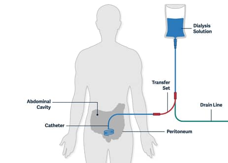 urology-cancer