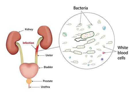 female-urology